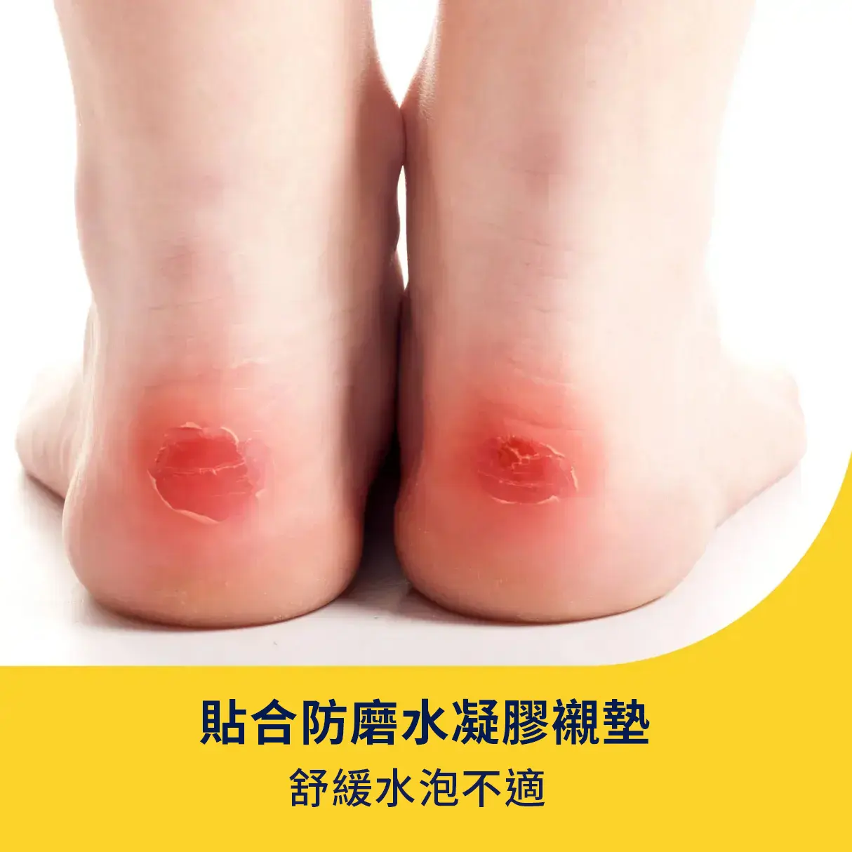 888853003221_Aid_BlisterCushions_ATF_05-Labor-scaled.webp